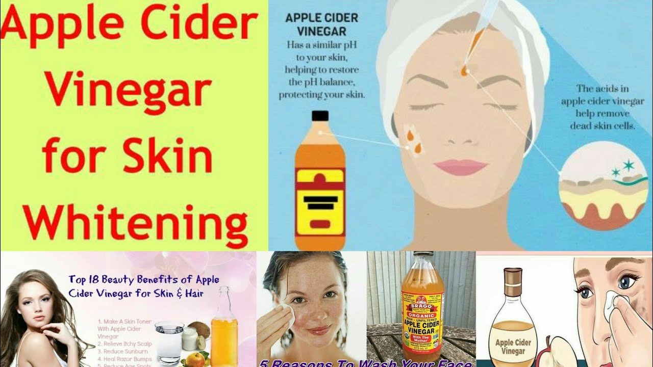 apple cider vinegar for razor burns home remedies for razor burn