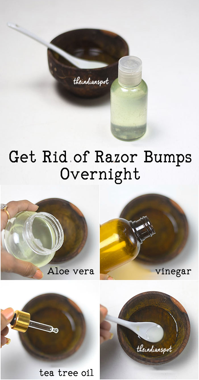 apple cider vinegar for razor bumps; aloe vera remedy